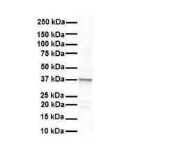 ERCC8 Rabbit anti-Human, Polyclonal, Novus Biologicals 100 &mu;g | Buy Online | Novus Biologicals | Fisher Scientific